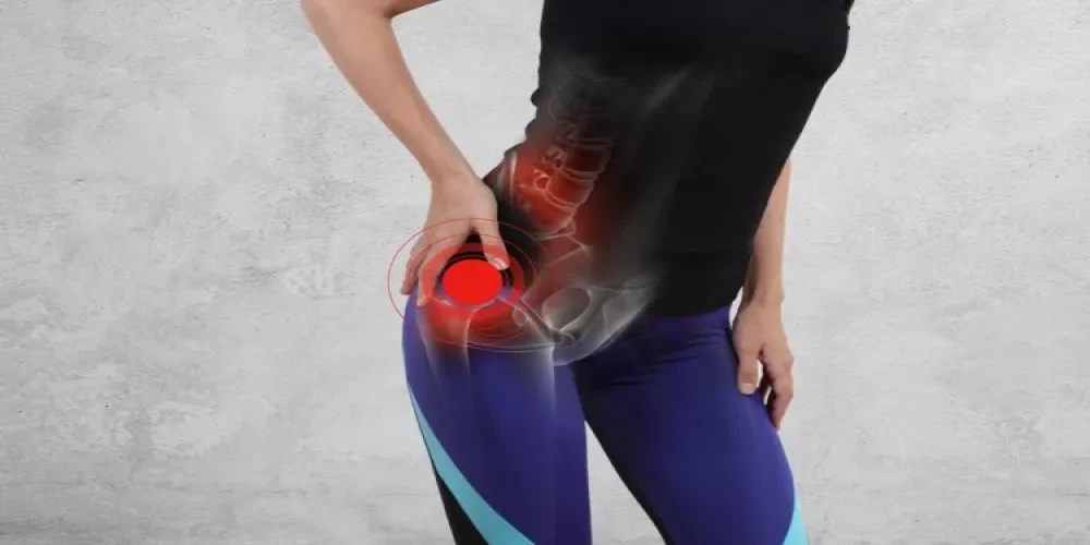 ما هو عرق النسا؟