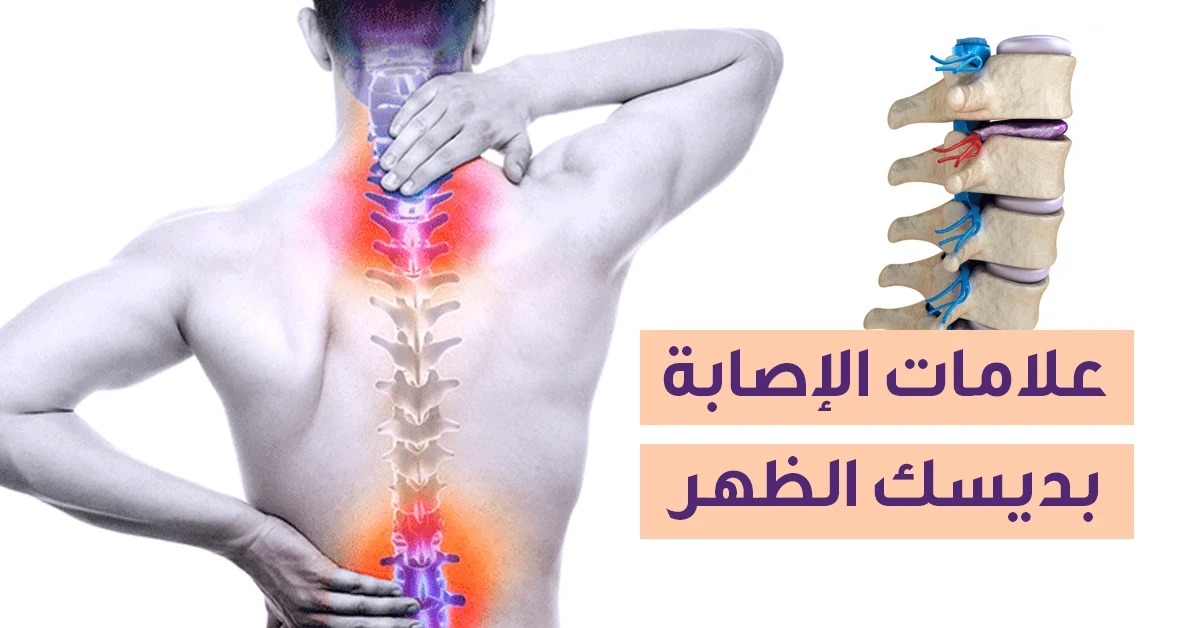 علاج آلام العمود الفقري المزمنة