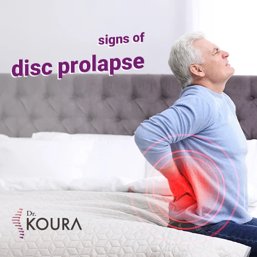 Signs of disc prolapse