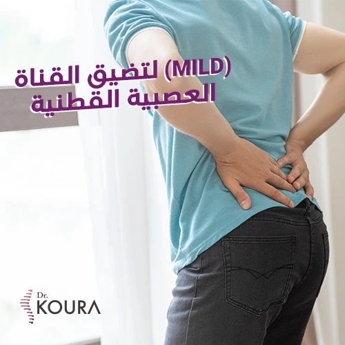 القناة العصبية القطنية MILD