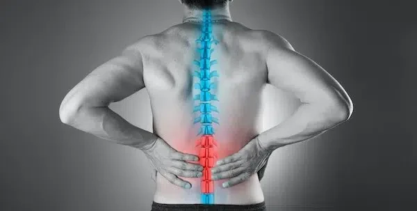 Spinal stenosis