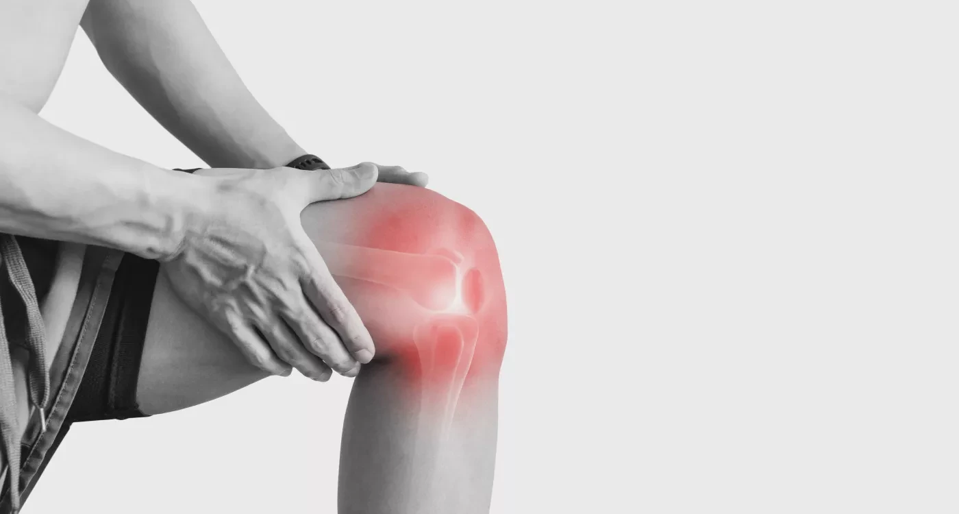 Knee Osteoarthritis